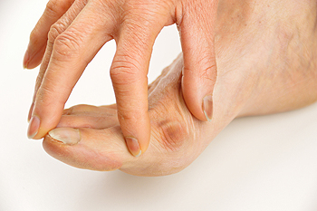 Bunion Relief